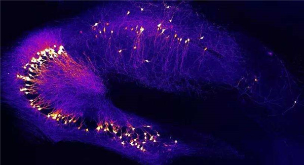 愛熬夜通宵、嗜糖嗜咸的我們,離阿爾茨海默病有多遠? 愛熬夜通宵、嗜糖嗜咸的我們,離阿爾茨海默病有多遠?