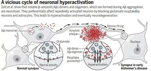 愛熬夜通宵、嗜糖嗜咸的我們,離阿爾茨海默病有多遠? 愛熬夜通宵、嗜糖嗜咸的我們,離阿爾茨海默病有多遠?