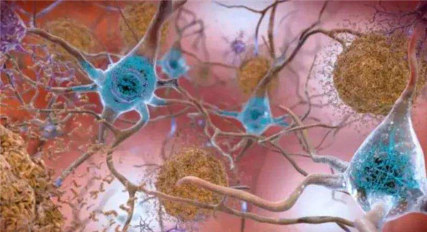 愛熬夜通宵、嗜糖嗜咸的我們,離阿爾茨海默病有多遠? 愛熬夜通宵、嗜糖嗜咸的我們,離阿爾茨海默病有多遠?