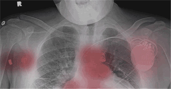 這些人不適合用iPhone 12,可能存在致命風(fēng)險(xiǎn) 這些人不適合用iPhone 12,可能存在致命風(fēng)險(xiǎn)